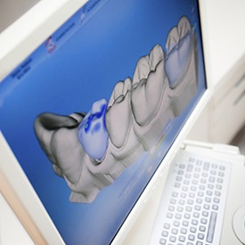 Digital smile design software