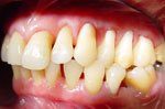 Smile following orthodontic treatment