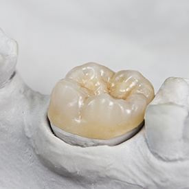 Model tooth with dental crown restoration