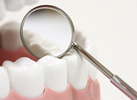 Closeup of teeth with dental sealants